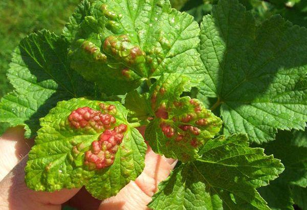 โรคลูกเกด