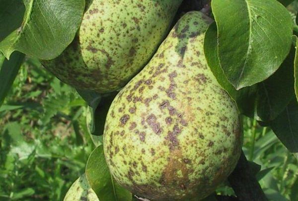 โรคสะเก็ดเงิน