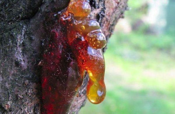 โรคเหงือกอักเสบ