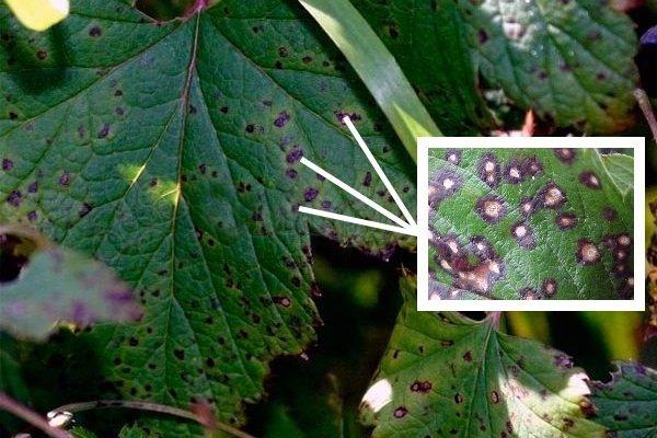 โรคลูกเกด