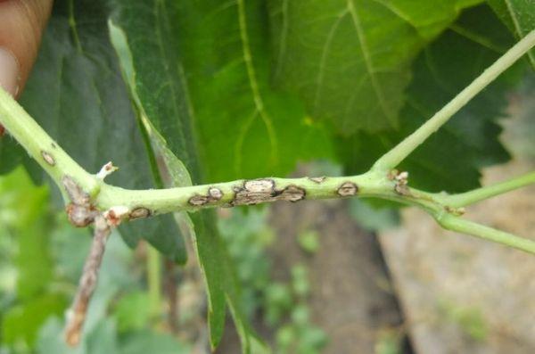 โรคองุ่น