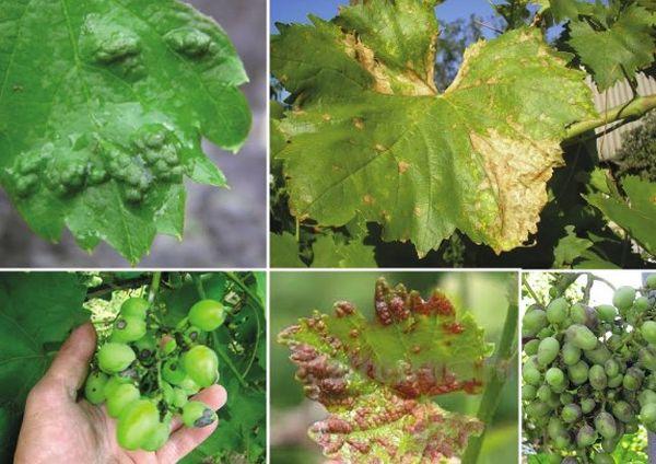 โรคองุ่น