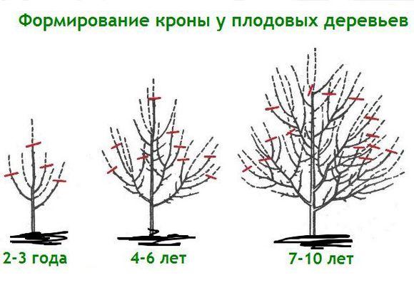 การขึ้นรูปมงกุฎ