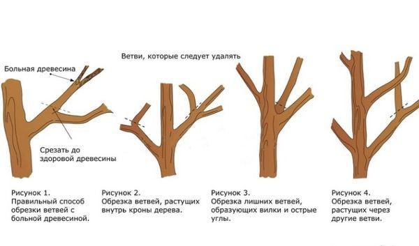 Formation de la couronne